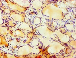 Cullin 4B / CUL4B Antibody (aa1-200)