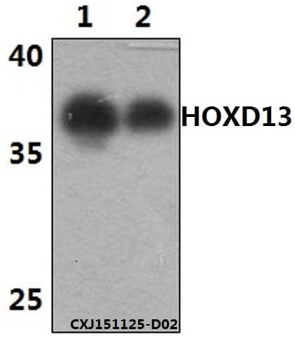 Polyclonal Rabbit anti-Human HOXD13 Antibody (WB)