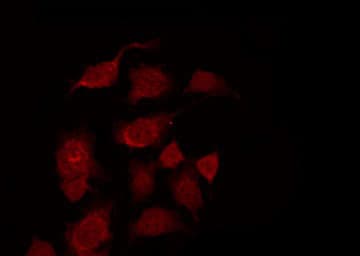 IKBKB / IKK2 / IKK Beta Antibody