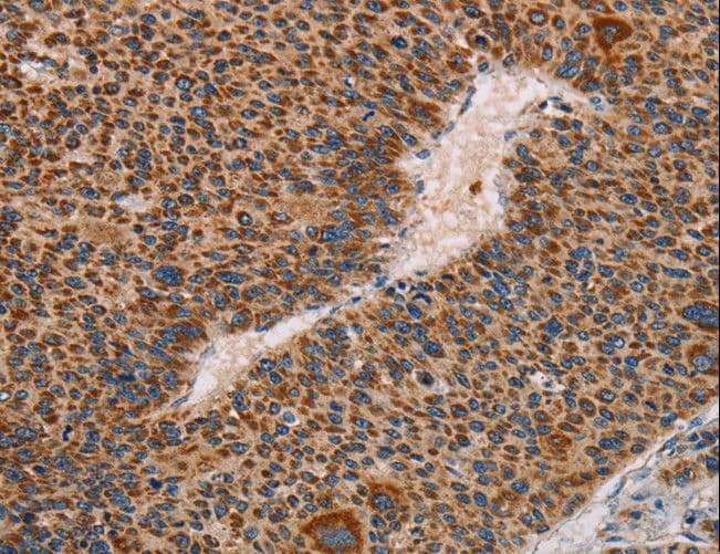MMP1 Antibody