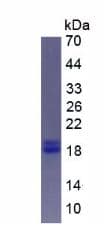 Mouse PTHLH / PTHRP Protein (Recombinant His, N-Terminal)