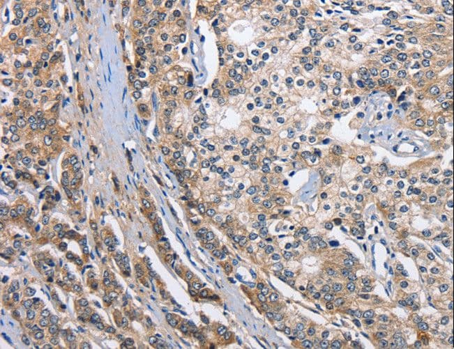 TARSH / ABI3BP Antibody