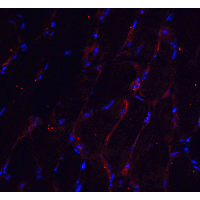 CHADL Antibody