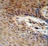 ZNF324 / ZF5128 Antibody (aa507-535)