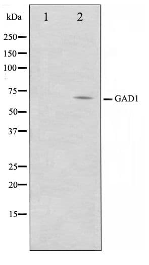 Polyclonal Rabbit anti-Human GAD1 / GAD67 Antibody (IHC, WB)