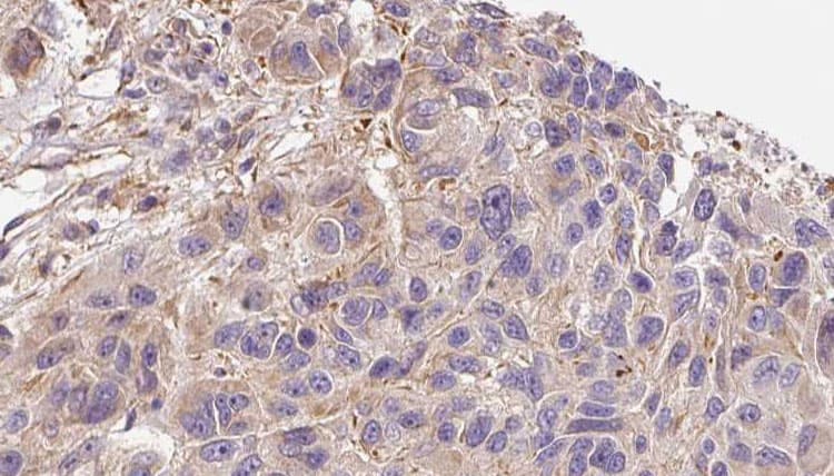 IL17A Antibody