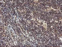 TP53 / p53 Antibody (clone OTI2H6, Carrier-free)