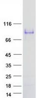 Human SMTNL1 Protein (Recombinant Myc-DDK (Flag))