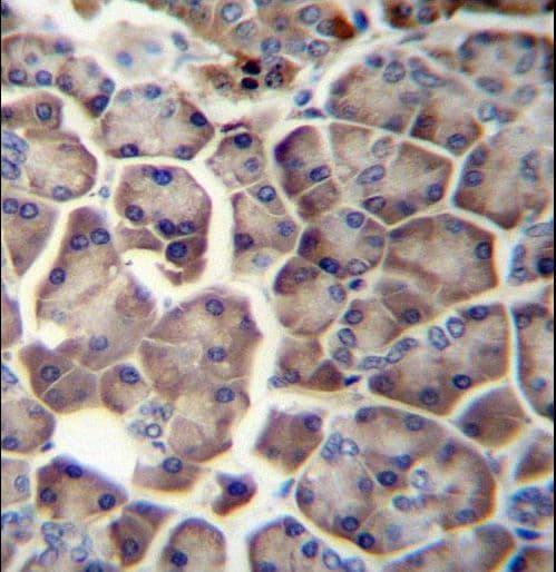 Polyclonal Rabbit anti-Human WDR12 Antibody (aa210-239, IHC, WB)