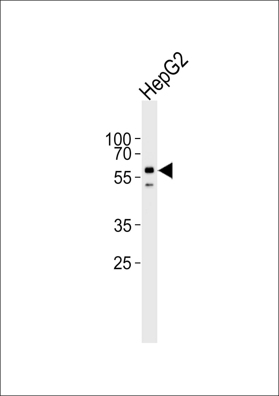 Polyclonal Rabbit anti-Human ALK2 / ACVR1 Antibody (aa132-162, IHC, WB)
