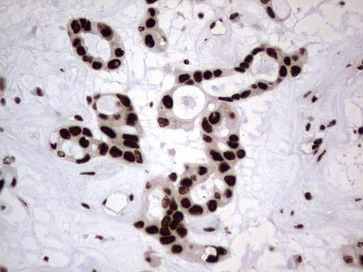 HNRNPL / hnRNP L Antibody (aa270-502, clone OTI9F11)