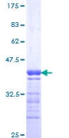 Human GPRC5C Protein (Recombinant GST, N-terminus)