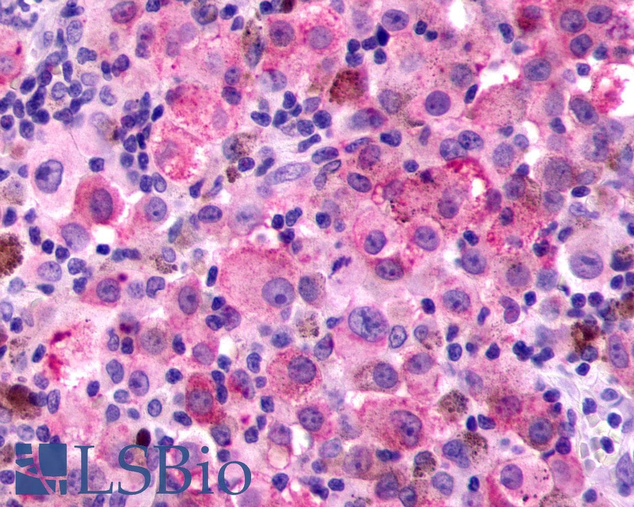 PathPlus™ F2RL3 / PAR4 Antibody (Cytoplasmic Domain)