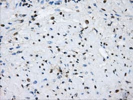 LOX / Lysyl Oxidase Antibody (clone OTI8G5)