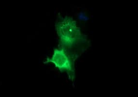 TH / Tyrosine Hydroxylase Antibody (clone OTI1A4, Carrier-free)