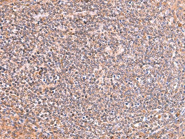 PHKG2 Antibody