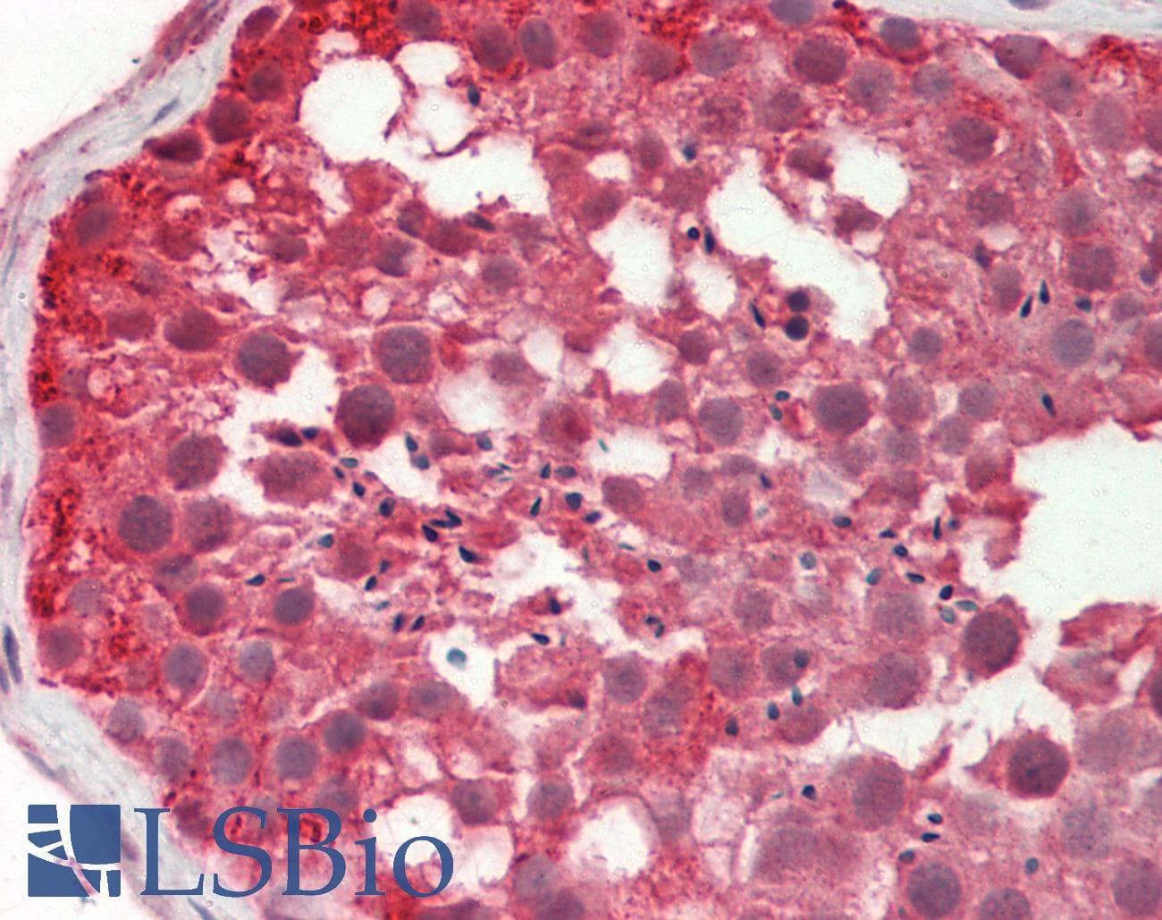 IHC-plus™ PMP70 Antibody