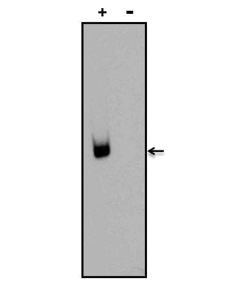 Digoxin Antibody (clone 38G12)
