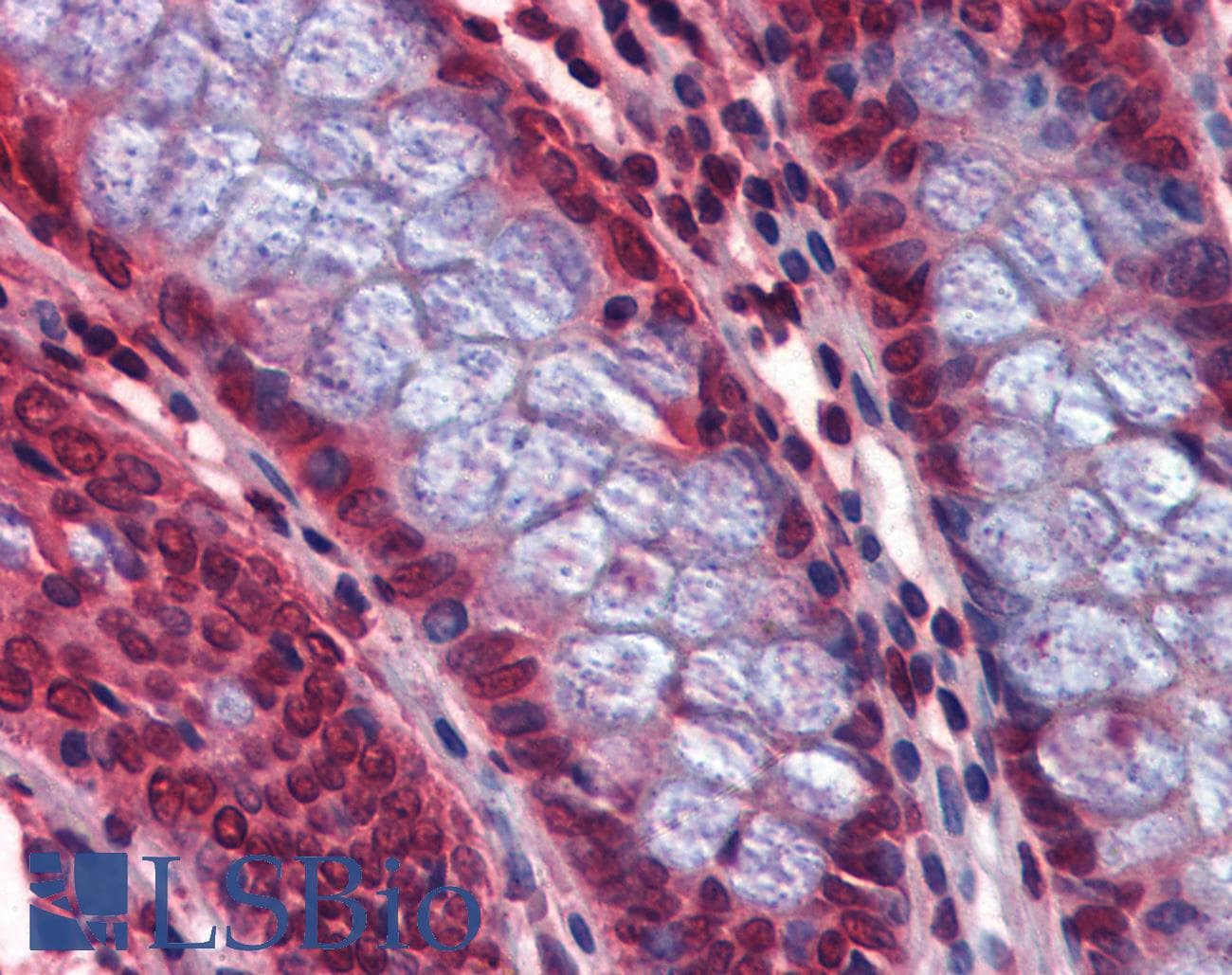 IHC-plus™ Polyclonal Rabbit anti-Human CAPS2 Antibody (IHC, IF, WB)