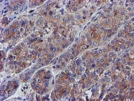 PYCRL Antibody (clone OTI3E1, Carrier-free)