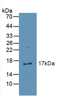 CAT / Catalase Antibody (aa32-167)