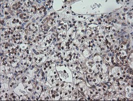 CCT8L2 Antibody (clone OTI1C1)
