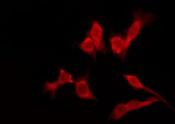 Polyclonal Rabbit anti-Human OR4K3 Antibody (IF, WB)
