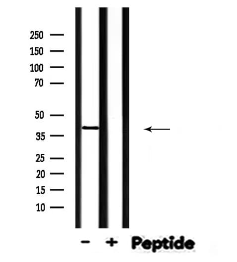 STK36 Antibody
