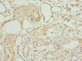 Polyclonal Rabbit anti-Human TAGLN2 / Transgelin 2 Antibody (IHC, WB)