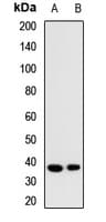 IHC-plus™ Polyclonal Rabbit anti-Human CD207 / Langerin Antibody (IHC, WB)