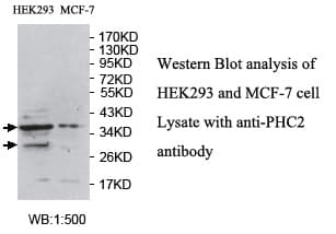 HPH2 / PHC2 Antibody (aa553-835)