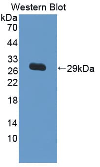 IL17RC Antibody (aa257-477, Cy3)