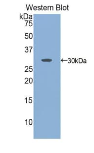 KNG1 / Kininogen / Bradykinin Antibody (aa390-644, Cy3)