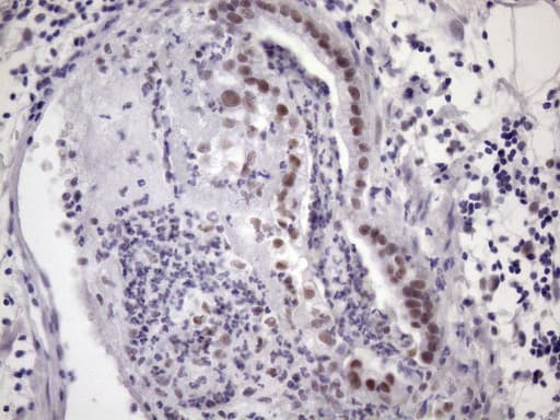SRSF9 / SFRS9 Antibody (clone OTI5G7)