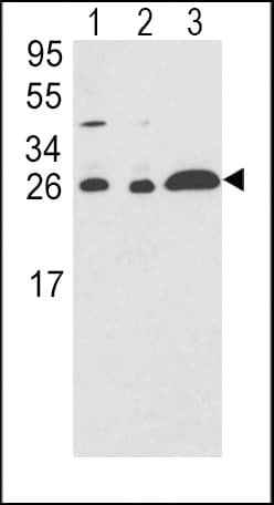 Polyclonal Rabbit anti-Human ARHGDIA / RHOGDI Antibody (aa112-140, IHC, WB)