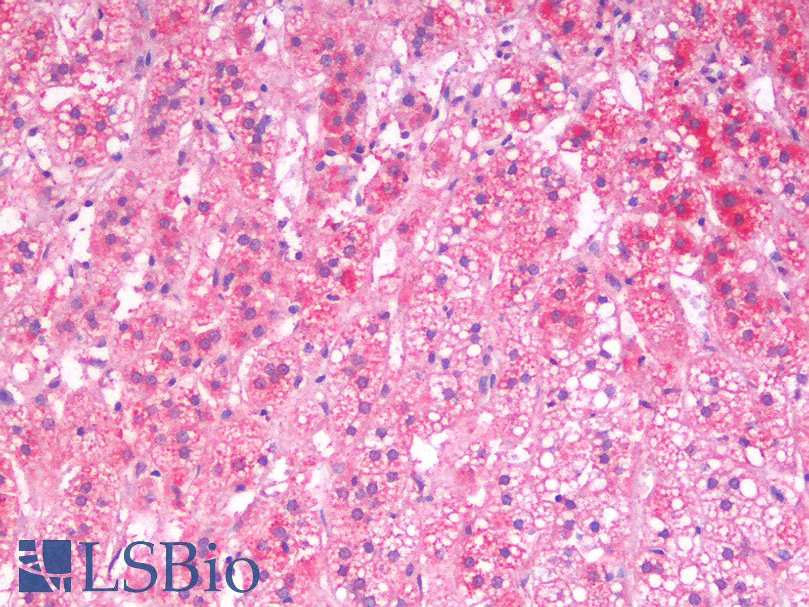 IHC-plus™ Polyclonal Goat anti-Human SGTA / SGT Antibody (Internal Region, IHC, WB)