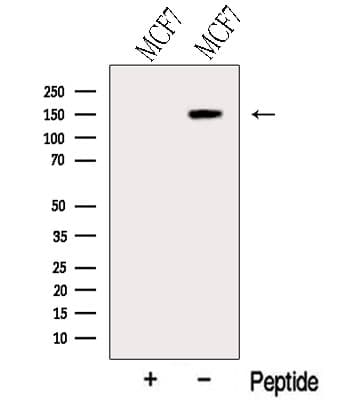ABCB4 / MDR3 Antibody