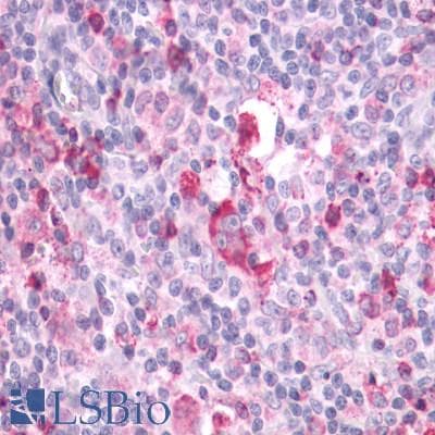 PathPlus™ APLNR/ Apelin Receptor / APJ Antibody (Cytoplasmic Domain)