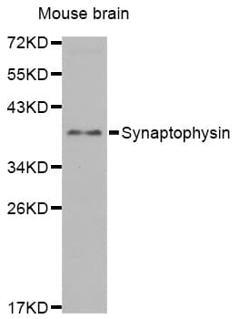 IHC-plus™ SYP / Synaptophysin Antibody