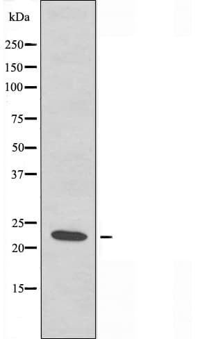 Polyclonal Rabbit anti-Human CHP2 Antibody (IF, WB)