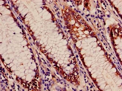 APH / APEH Antibody