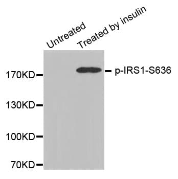 IRS1 Antibody (phospho-Ser636)