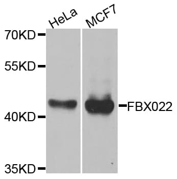 Polyclonal Rabbit anti-Human FBXO22 Antibody (WB)
