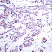 Polyclonal Rabbit anti-Human STAT6 Antibody (IHC, WB)