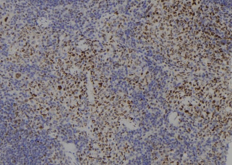 SMC3 / HCAP Antibody