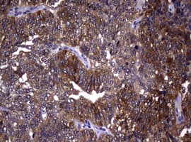 R1 / RRM1 Antibody (aa541-792, clone OTI5G5, Carrier-free)