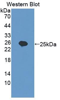 MYLK2 Antibody (aa327-536, PE)