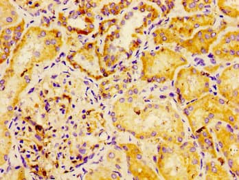 Dysferlin Antibody (aa105-278)