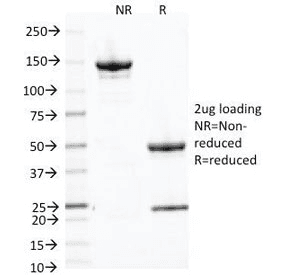 Monoclonal Mouse anti-Human CD71 / Transferrin Receptor Antibody (clone 66IG10, IF)