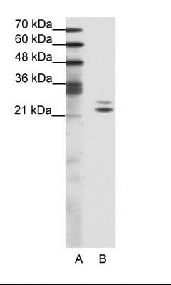 Polyclonal Rabbit anti-Human BUD31 Antibody (aa71-120, WB)